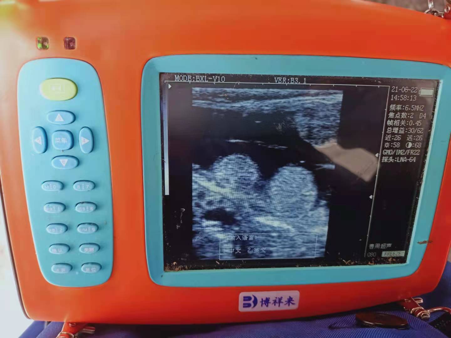 Dynamic aperture technology in veterinary ultrasound system(图1)