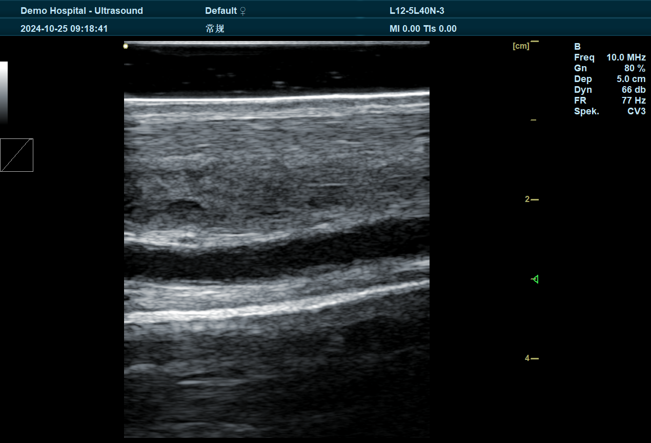 Application of Boxianglai Ultrasound Instruments in Veterinary Medicine(图1)