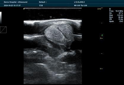 BXL Veterinary Ultrasound Diagnosis: A Complete Guide for Accurate Animal Health Assessments(图1)