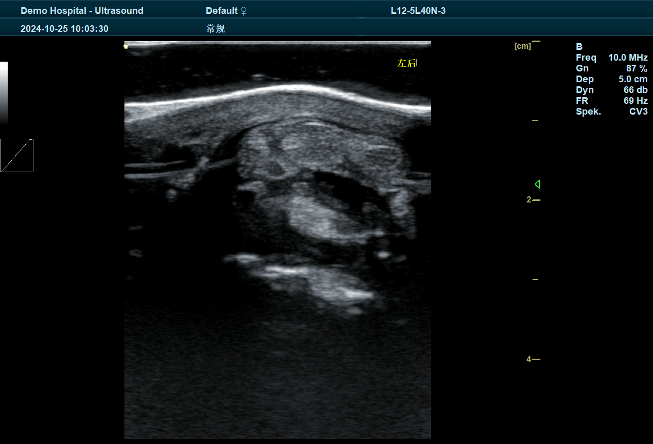 BXL Ultrasound Testing of Horse Tendons: A Game-Changer for Equine Health and Performance(图2)