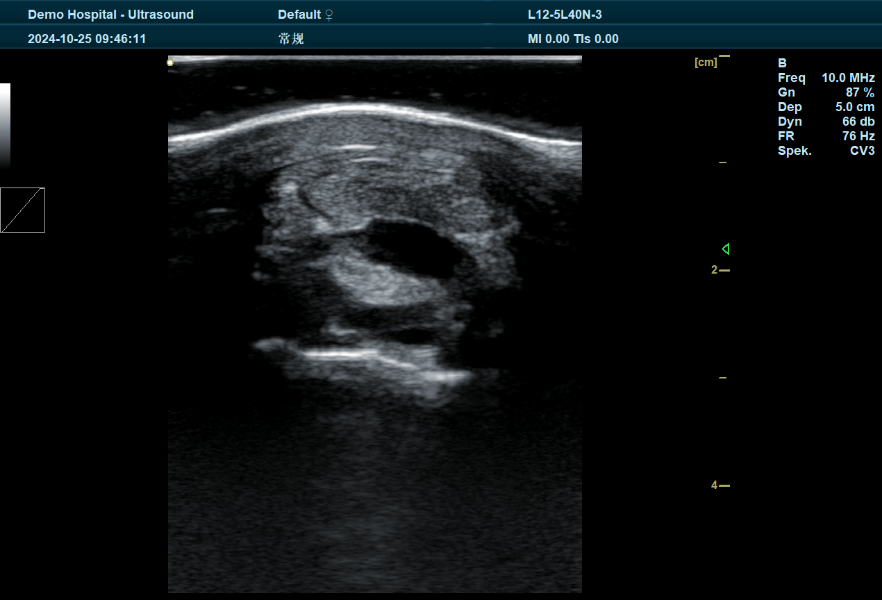 BXL Ultrasound Testing of Horse Tendons: A Game-Changer for Equine Health and Performance(图1)