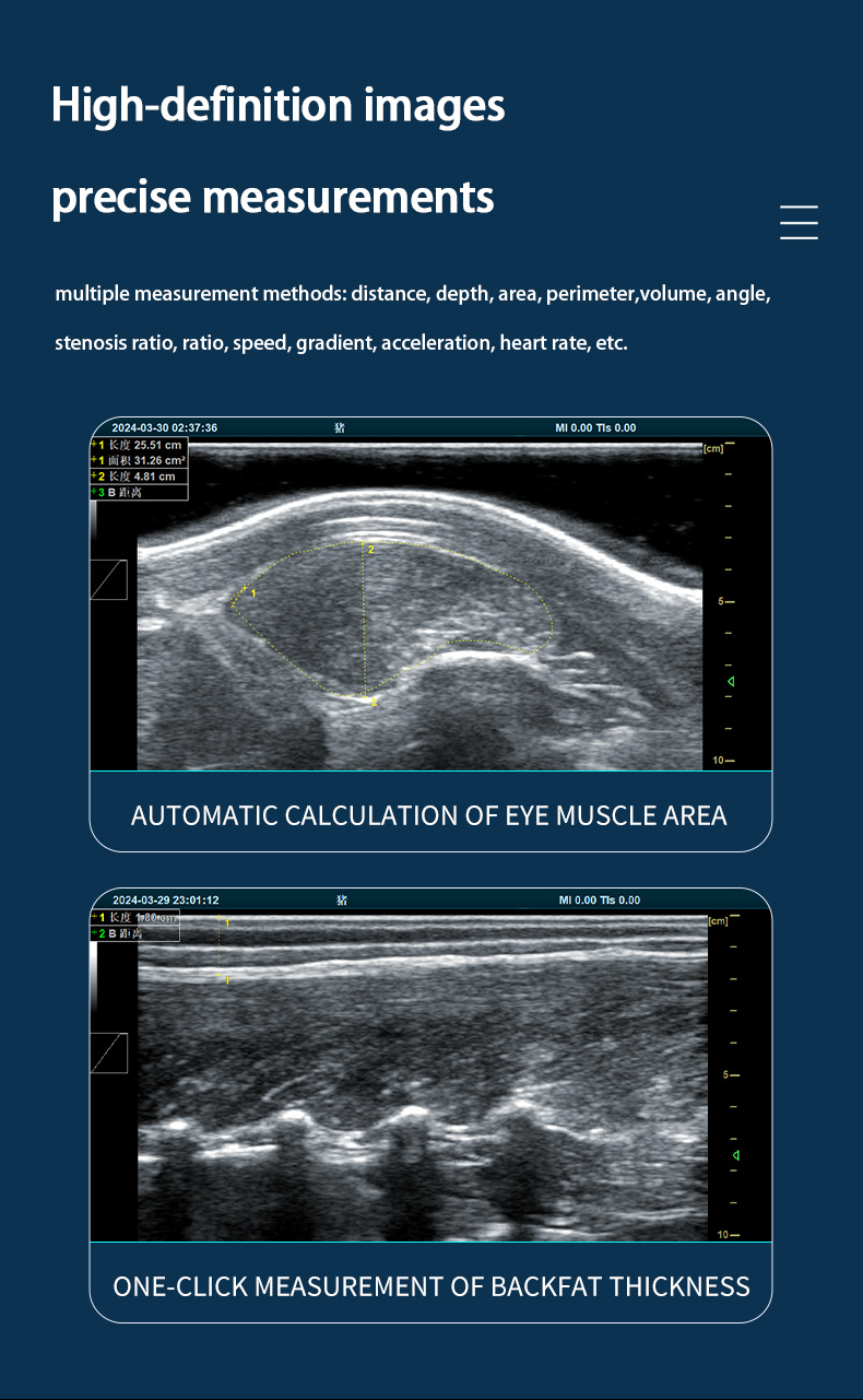 DB20 Back Fat eyes muscle measuring instrument(图3)