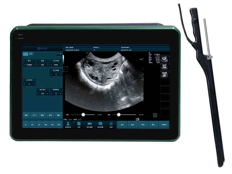 Veterinary High-end Multifunctional Ultrasound Machine Price(图2)