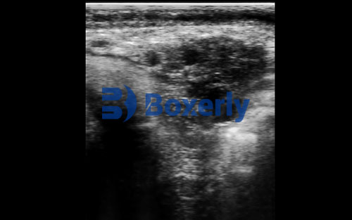 BXL Cheap Vet Ultrasound Machine | Low-Cost Choice for Animal Husbandry(图6)