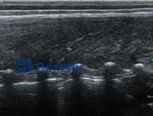 Ultrasound Devices for Swine: Specific Functions and Practical Applications in the Global Market(图3)