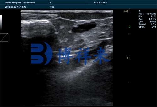 Ultrasound Application in Gonadal Detection of Sebastes schlegelii(图3)