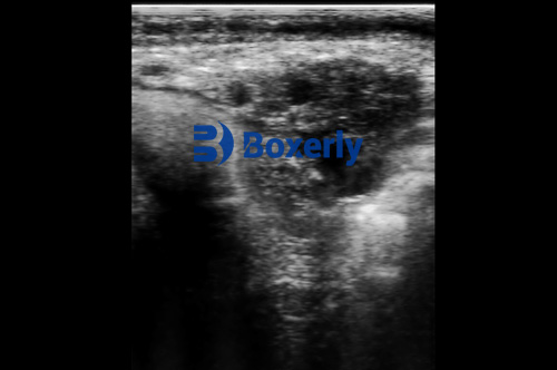 Using Bovine Ultrasound to Detect Ovarian Cysts in Dairy Cows(图3)