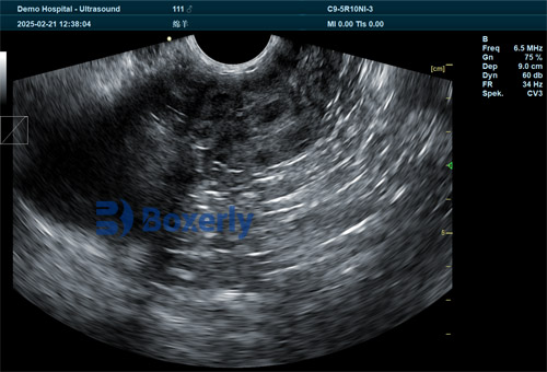 Discover Advanced Sheep Ultrasound Machine for Sale: Improve Breeding Accuracy Today(图2)